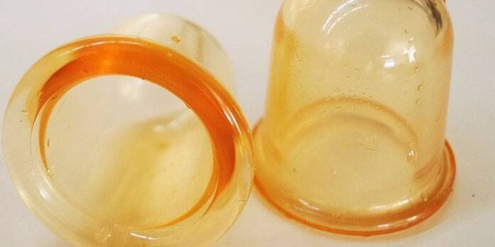 xícaras para o tratamento da prostatite